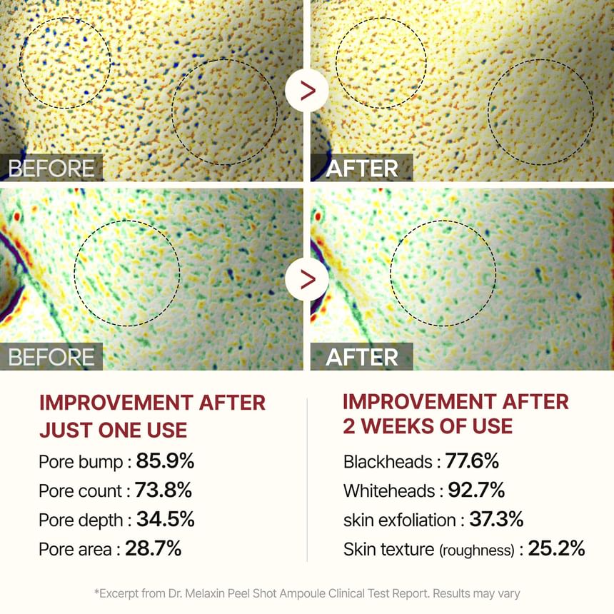 Dr. Melaxin SkinCare Peel Shot