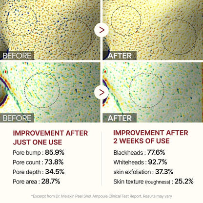 Dr. Melaxin SkinCare Peel Shot